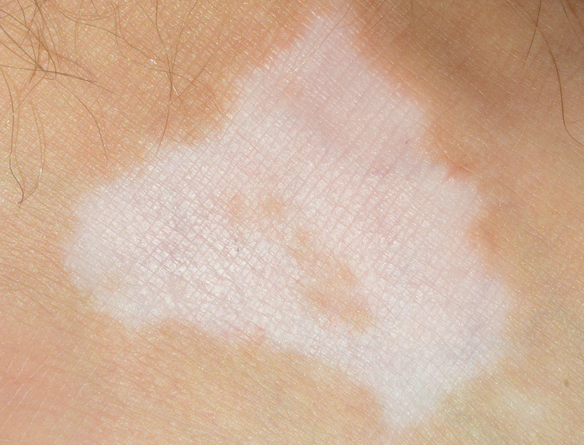 ÇൺÄÄÀ￴ţƤѢҽԺºÃÄØ£¿ÇൺţƤѢҽԺÅÅÃûǰÈýλÃû¼